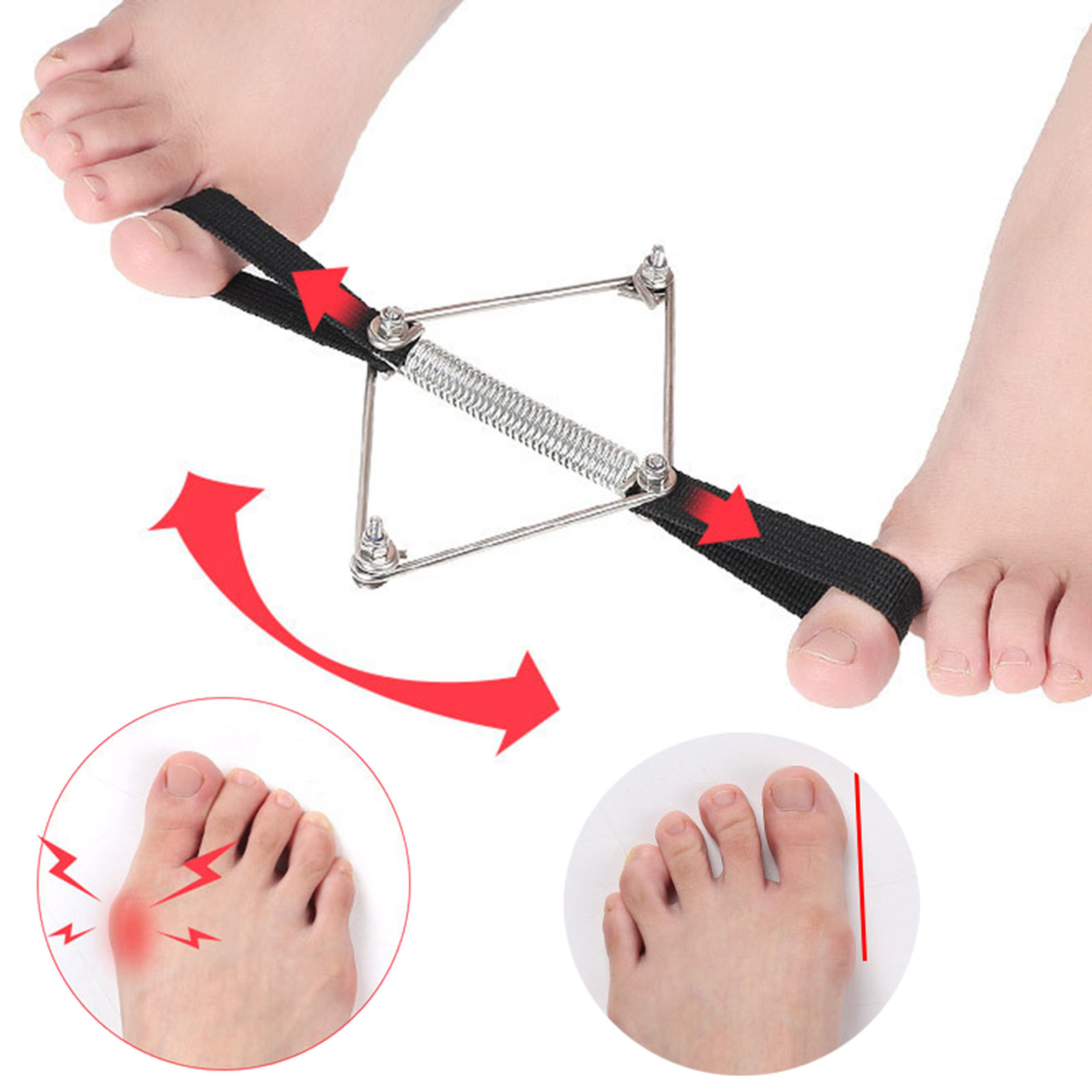 Bunion Corrector Nylon Steel S - مراجعة Pilates Yoga Wellness وسعره